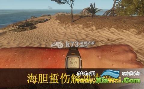深海搁浅被海胆蛰伤解决方法